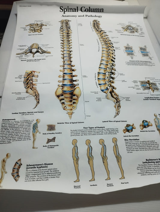 Spinal Column Anatomy and Pathology Stampa Su Tela misure 50 X 70 circa