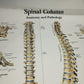 Spinal Column Anatomy and Pathology Stampa Su Tela misure 50 X 70 circa