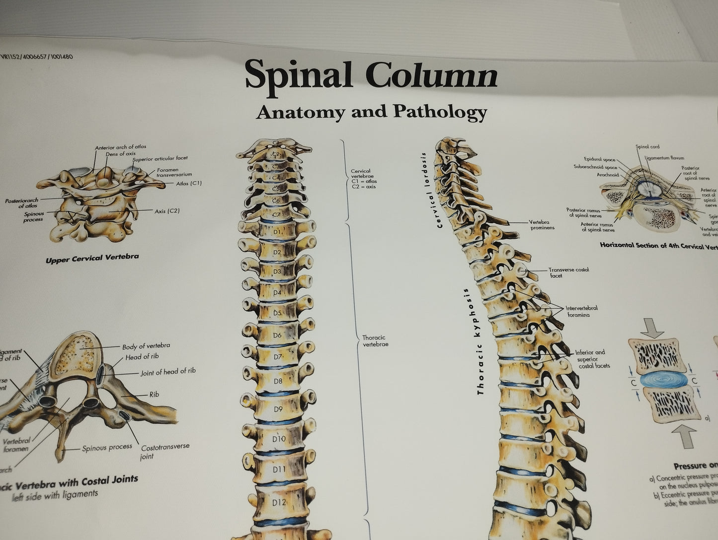 Spinal Column Anatomy and Pathology Stampa Su Tela misure 50 X 70 circa