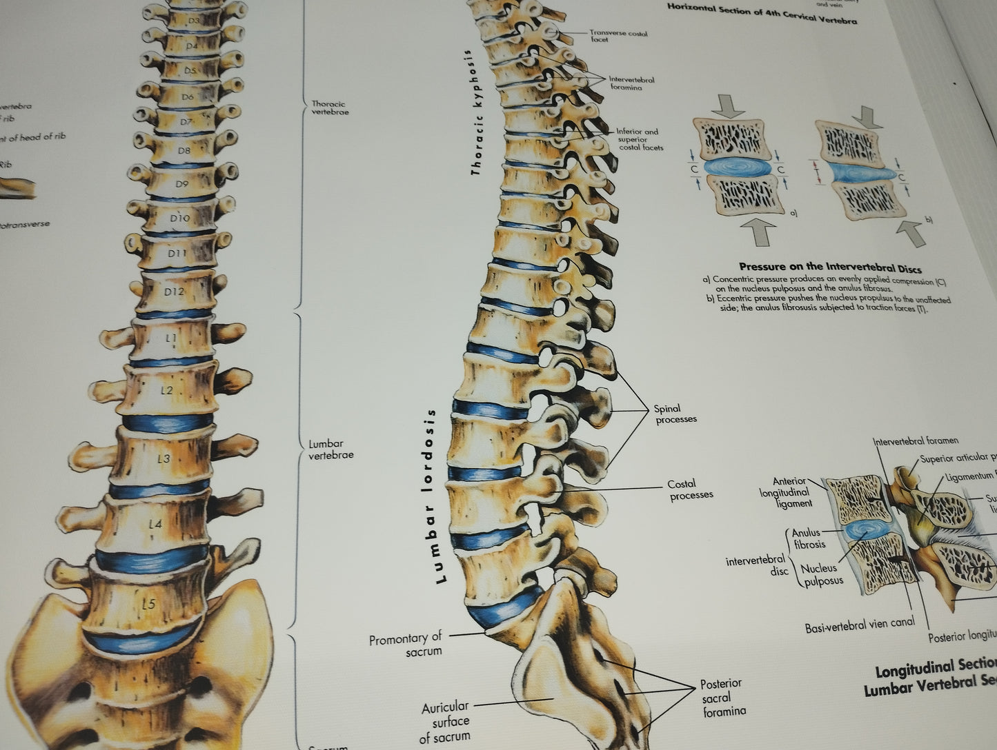 Spinal Column Anatomy and Pathology Stampa Su Tela misure 50 X 70 circa