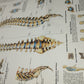 Spinal Column Anatomy and Pathology Stampa Su Tela misure 50 X 70 circa