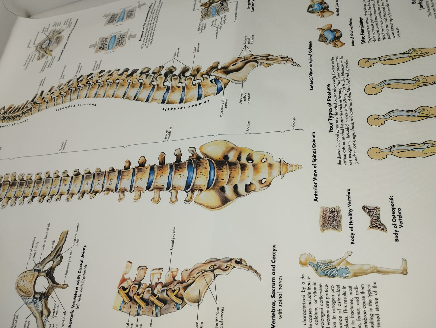 Spinal Column Anatomy and Pathology Stampa Su Tela misure 50 X 70 circa