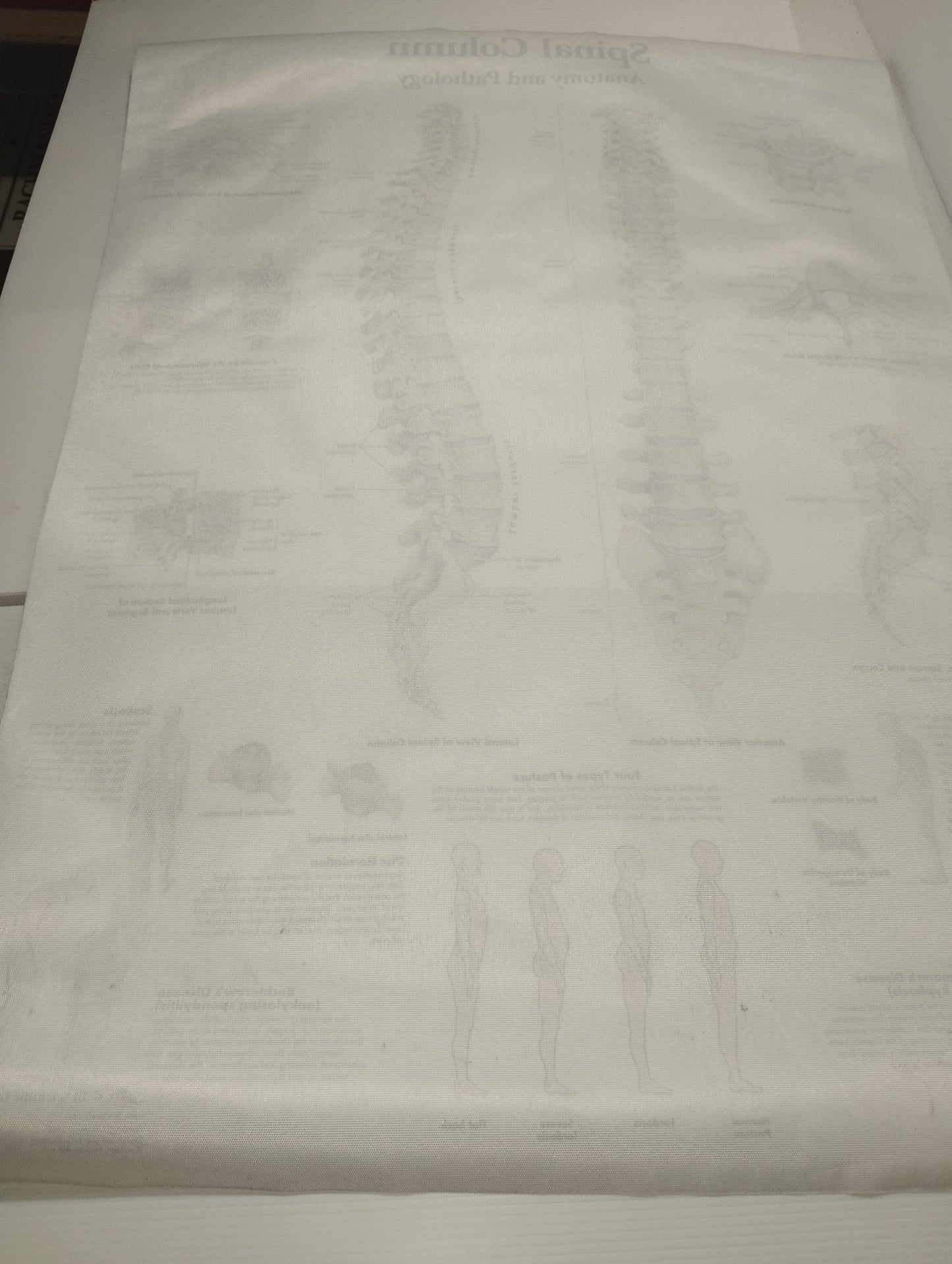 Spinal Column Anatomy and Pathology Stampa Su Tela misure 50 X 70 circa